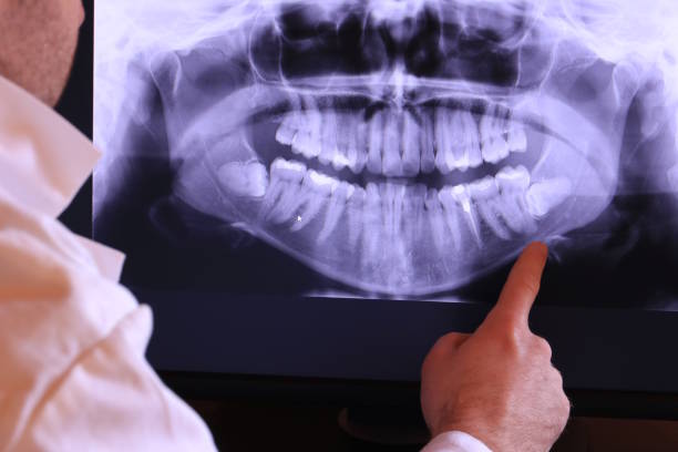 Best Emergency Wisdom Teeth Removal in Taft Southwest, TX