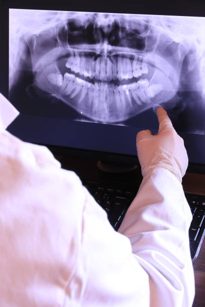 Best Emergency Tooth Extraction in Taft Southwest, TX