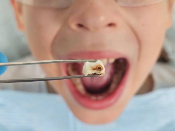 Best Same-Day Emergency Dentist in Taft Southwest, TX